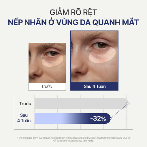 Serum mắt giảm nếp nhăn & ngừa lão hóa INNISFREE GREEN TEA PDRN EYE SERUM