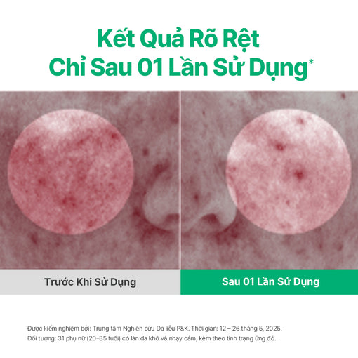 Kem dưỡng ẩm phục hồi INNISFREE GREEN TEA CERAMIDE CREAM 50mL