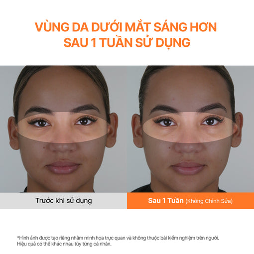 Serum Mắt Dưỡng Sáng, Mờ Thâm INNISFREE Vitamin C Niacinamide Brightening Eyes Serum