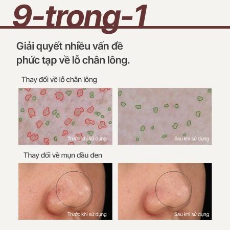 Siêu mặt nạ đất sét tro núi lửa giảm nhờn, thu nhỏ lỗ chân lông INNISFREE Super Volcanic Pore Clay Mask 100mL