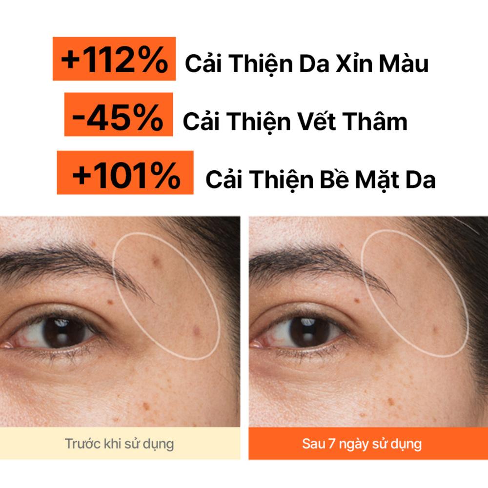 Serum Vitamin C sáng da, mờ thâm mụn INNISFREE Green Tea Enzyme Brightening Serum 30ml