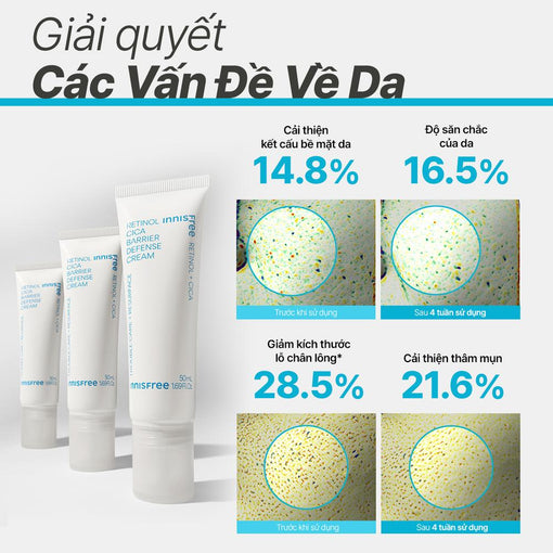 Kem dưỡng làm dịu và phục hồi da INNISFREE Retinol Cica Barrier Defense Cream 50 mL