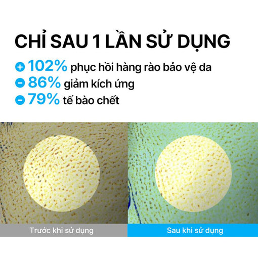 Serum Kiểm Soát Dầu Mụn Cho Da Láng Mịn INNISFREE Retinol Cica Repair Ampoule 50mL