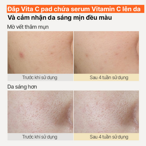 Vita C Pad dưỡng sáng da 60 miếng innisfree Vita C Pad Green Tea Enzyme 170 mL